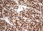 FBXW7 Antibody in Immunohistochemistry (Paraffin) (IHC (P))