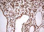 FBXW7 Antibody in Immunohistochemistry (Paraffin) (IHC (P))