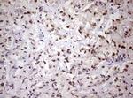 FBXW7 Antibody in Immunohistochemistry (Paraffin) (IHC (P))