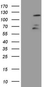 FBXW7 Antibody in Western Blot (WB)