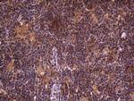 DOCK8 Antibody in Immunohistochemistry (Paraffin) (IHC (P))