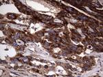 DOCK8 Antibody in Immunohistochemistry (Paraffin) (IHC (P))