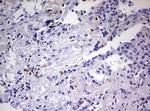 PRRX1 Antibody in Immunohistochemistry (Paraffin) (IHC (P))