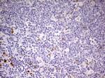 PRRX1 Antibody in Immunohistochemistry (Paraffin) (IHC (P))