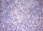 PRRX1 Antibody in Immunohistochemistry (Paraffin) (IHC (P))