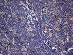 PRRX1 Antibody in Immunohistochemistry (Paraffin) (IHC (P))