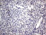 PRRX1 Antibody in Immunohistochemistry (Paraffin) (IHC (P))