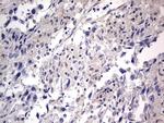 PRRX1 Antibody in Immunohistochemistry (Paraffin) (IHC (P))