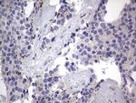 PRRX1 Antibody in Immunohistochemistry (Paraffin) (IHC (P))