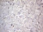 PRRX1 Antibody in Immunohistochemistry (Paraffin) (IHC (P))