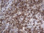 PRRX1 Antibody in Immunohistochemistry (Paraffin) (IHC (P))