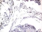 PRRX1 Antibody in Immunohistochemistry (Paraffin) (IHC (P))