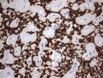 KRT24 Antibody in Immunohistochemistry (Paraffin) (IHC (P))