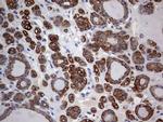 KRT24 Antibody in Immunohistochemistry (Paraffin) (IHC (P))