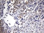 ABCD1 Antibody in Immunohistochemistry (Paraffin) (IHC (P))