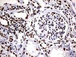 DDX56 Antibody in Immunohistochemistry (Paraffin) (IHC (P))