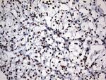 DDX56 Antibody in Immunohistochemistry (Paraffin) (IHC (P))