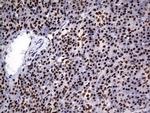 DDX56 Antibody in Immunohistochemistry (Paraffin) (IHC (P))