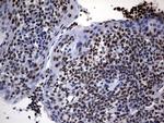 DDX56 Antibody in Immunohistochemistry (Paraffin) (IHC (P))