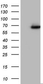 DDX56 Antibody in Western Blot (WB)