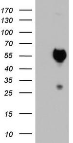 SAP30BP Antibody in Western Blot (WB)