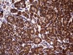 GBA Antibody in Immunohistochemistry (Paraffin) (IHC (P))