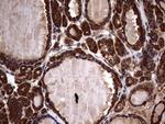 GBA Antibody in Immunohistochemistry (Paraffin) (IHC (P))