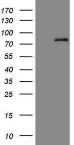 ABCD1 Antibody in Western Blot (WB)