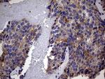 IRAK2 Antibody in Immunohistochemistry (Paraffin) (IHC (P))