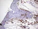 TACC2 Antibody in Immunohistochemistry (Paraffin) (IHC (P))