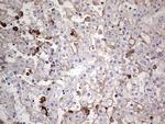 TACC2 Antibody in Immunohistochemistry (Paraffin) (IHC (P))