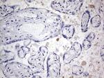 TACC2 Antibody in Immunohistochemistry (Paraffin) (IHC (P))