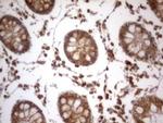 IGSF11 Antibody in Immunohistochemistry (Paraffin) (IHC (P))