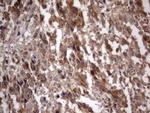 IGSF11 Antibody in Immunohistochemistry (Paraffin) (IHC (P))