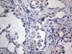 IGSF11 Antibody in Immunohistochemistry (Paraffin) (IHC (P))