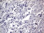 IGSF11 Antibody in Immunohistochemistry (Paraffin) (IHC (P))