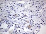 IGSF11 Antibody in Immunohistochemistry (Paraffin) (IHC (P))