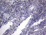 IGSF11 Antibody in Immunohistochemistry (Paraffin) (IHC (P))