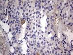 IGSF11 Antibody in Immunohistochemistry (Paraffin) (IHC (P))