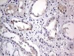 IGSF11 Antibody in Immunohistochemistry (Paraffin) (IHC (P))