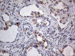 IGSF11 Antibody in Immunohistochemistry (Paraffin) (IHC (P))