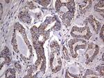 IGSF11 Antibody in Immunohistochemistry (Paraffin) (IHC (P))