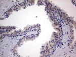 IGSF11 Antibody in Immunohistochemistry (Paraffin) (IHC (P))