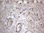 IGSF11 Antibody in Immunohistochemistry (Paraffin) (IHC (P))