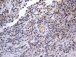 IGSF11 Antibody in Immunohistochemistry (Paraffin) (IHC (P))