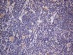 IGSF11 Antibody in Immunohistochemistry (Paraffin) (IHC (P))