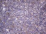 IGSF11 Antibody in Immunohistochemistry (Paraffin) (IHC (P))