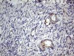 IGSF11 Antibody in Immunohistochemistry (Paraffin) (IHC (P))