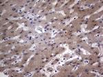 IGSF11 Antibody in Immunohistochemistry (Paraffin) (IHC (P))