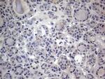 IGSF11 Antibody in Immunohistochemistry (Paraffin) (IHC (P))